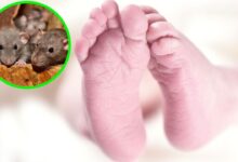 Maltrato infantil: bebé es atacado por ratas en su cuna, casi fue devorado vivo y quedó desfigurado